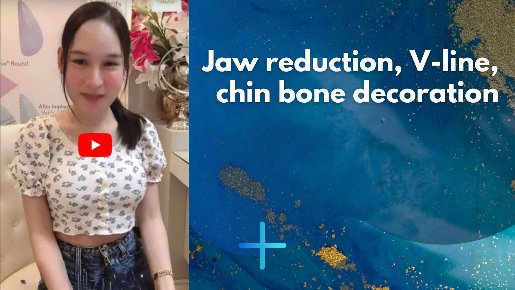 How a V-line jaw cut and chin bone decoration surgery can change lives | Milada Cosmetic Surgery Hospital