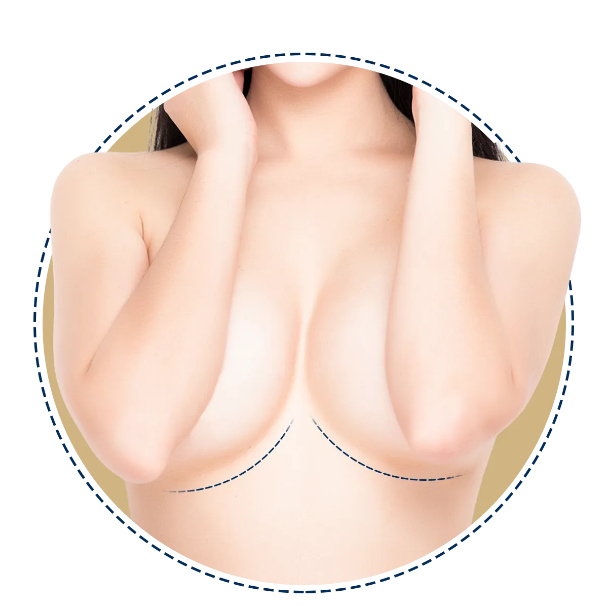 Breast Augmentation | Milada Plastic Surgery Hospital 